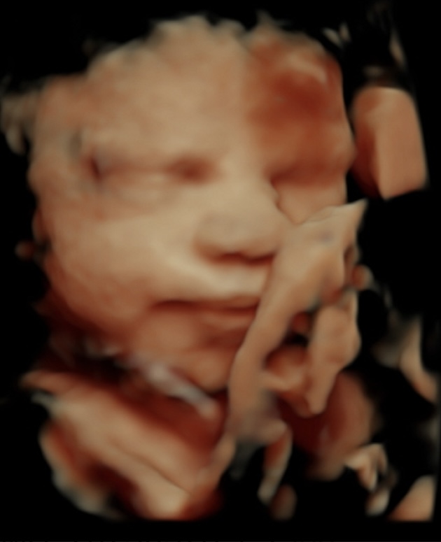 8k Baby Ultrasound Image Transform 3D And 4D Ultrasound Scans